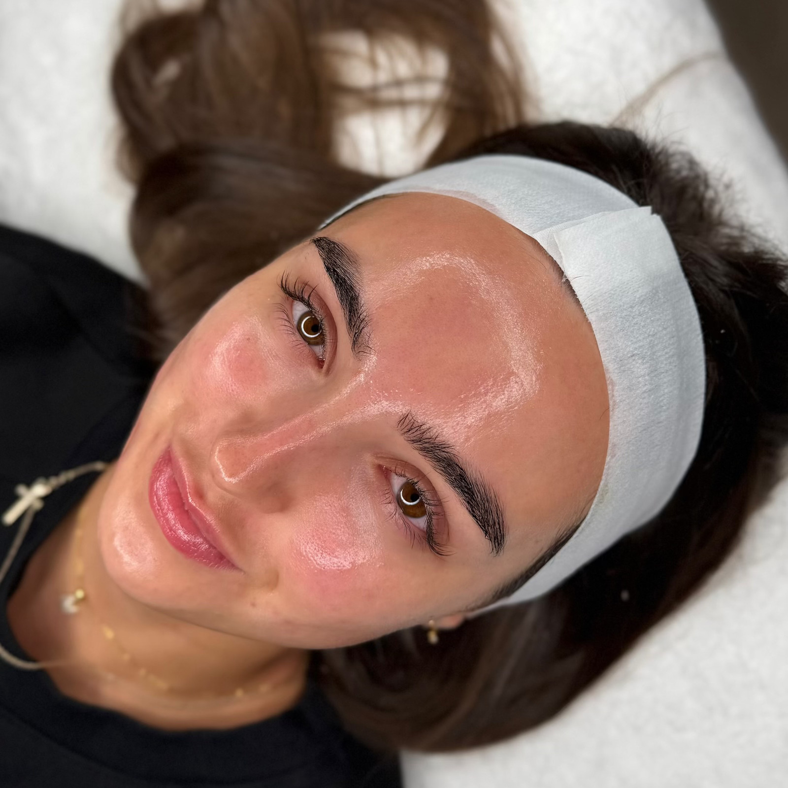 Treatment: BioRePeel