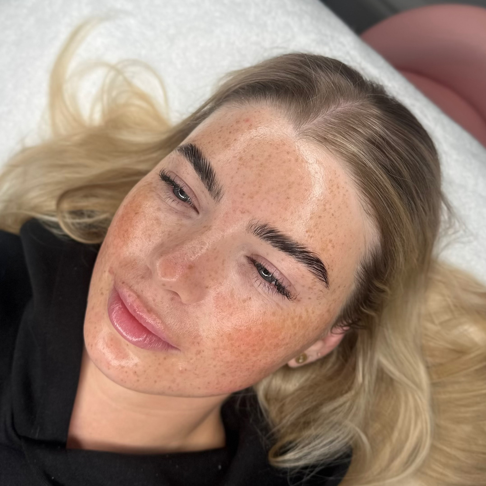 Treatment: Dermaplaning & Microdermabrasion