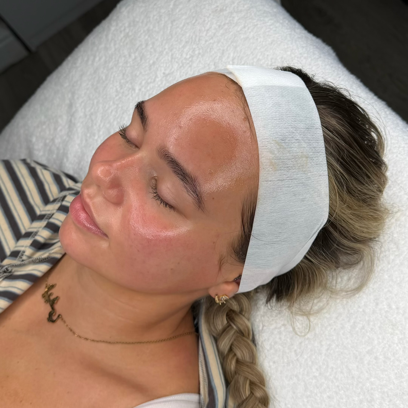 Treatment: Dermaplaning